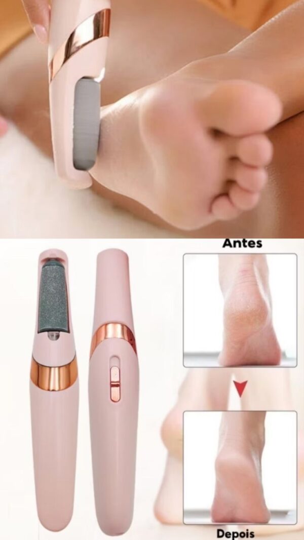 Lixador de Pés Recarregável DERMA VAC - Image 3