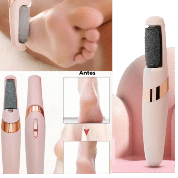 Lixador de Pés Recarregável DERMA VAC